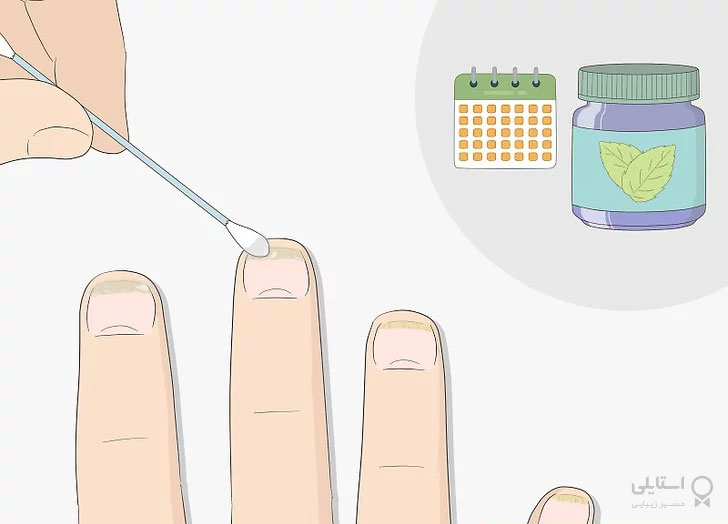  برای درمان طولانی مدت 1 بار در روز پماد نعناعی را روی ناخنتان ماساژ دهید
