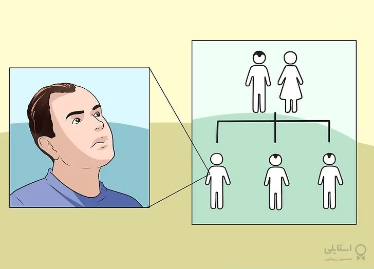 درمان ریزش مو