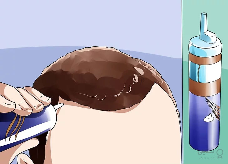 درمان ریزش مو