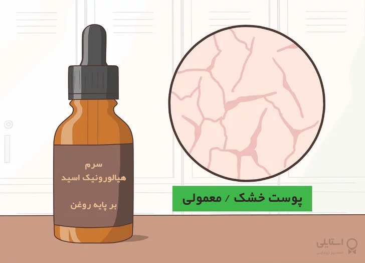 سرم هیالورونیک اسید