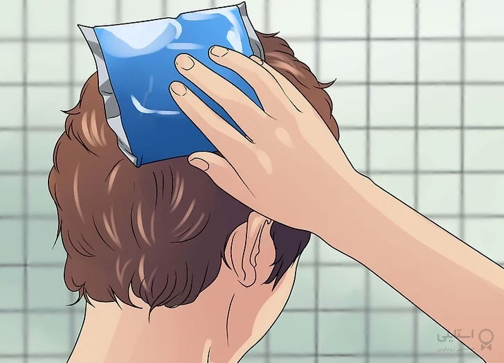 آفتاب سوختگی