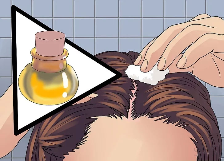 آفتاب سوختگی