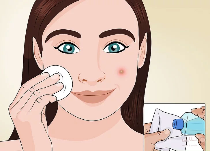 تونر برای پوست