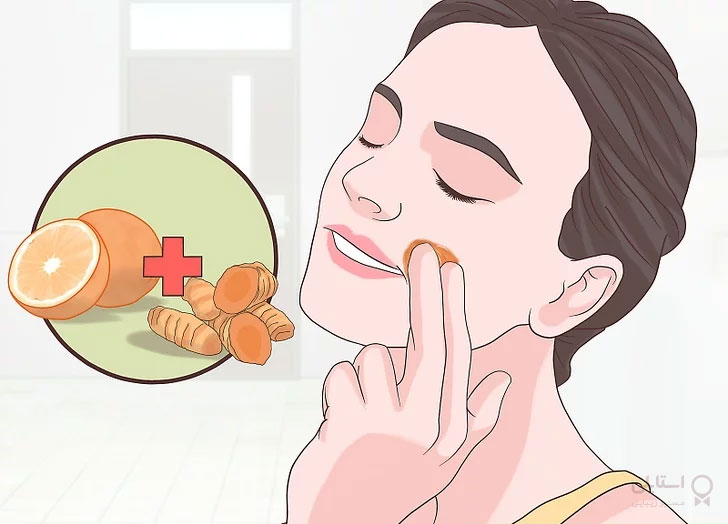 کرم سفید کننده پوست