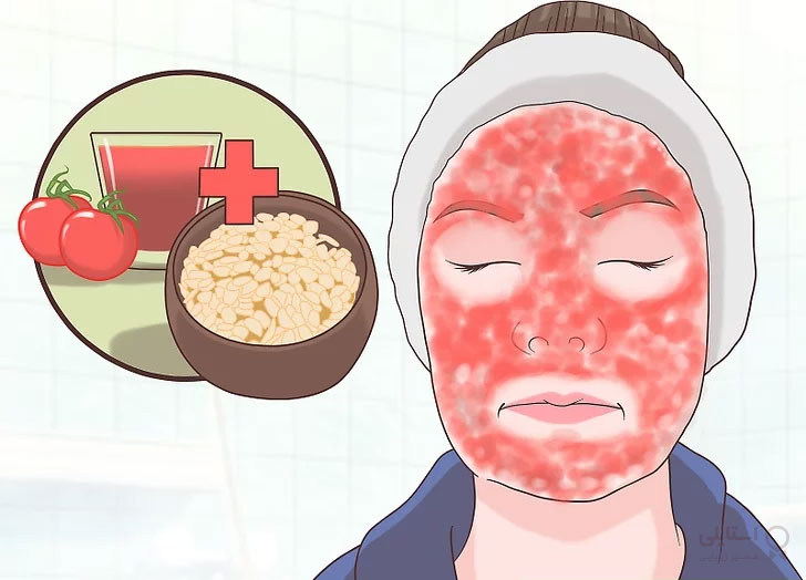 کرم سفید کننده پوست