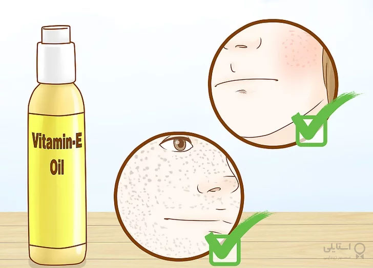 روغن ویتامین E