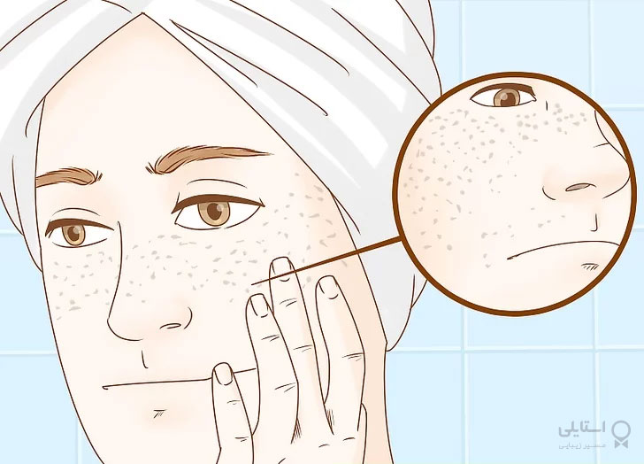 روغن ویتامین E