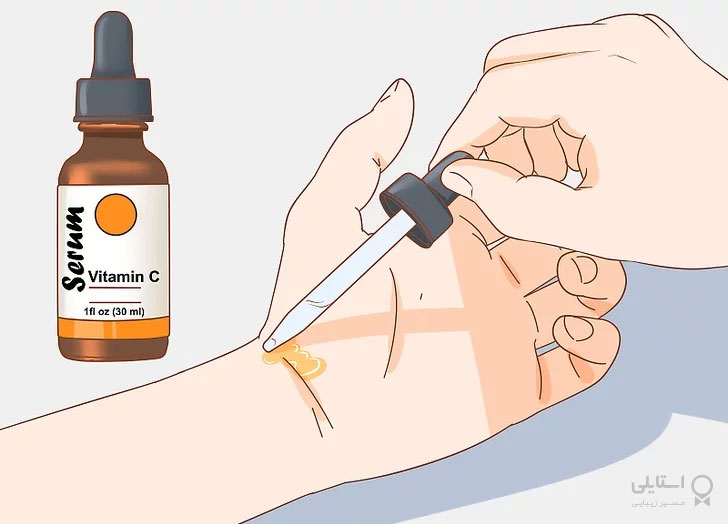 زدن سرم ویتامین C روی مچ دست برای تشخیص آلرژی 