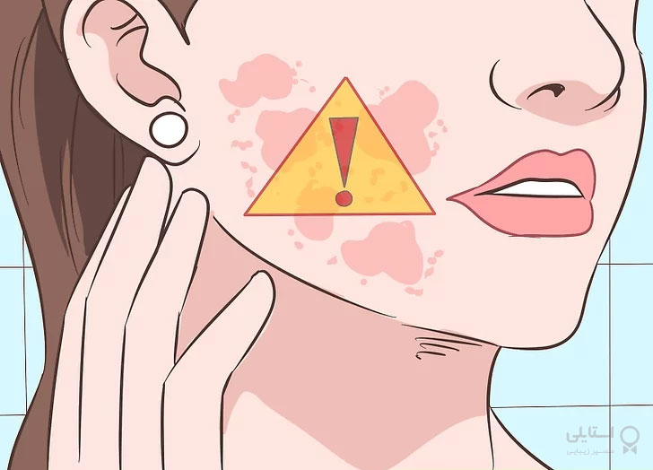 بٍورات پوستی