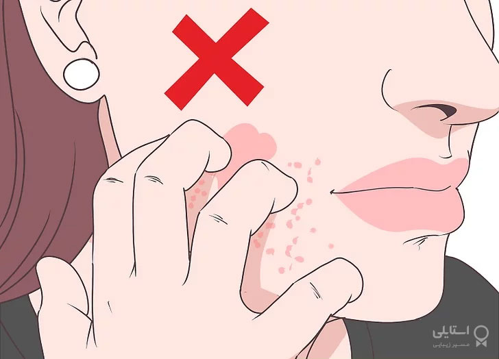 بٍورات پوستی