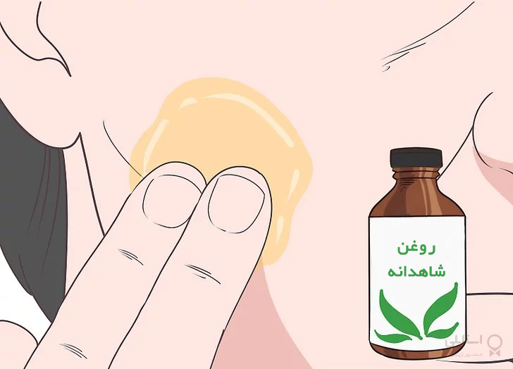 بٍورات پوستی