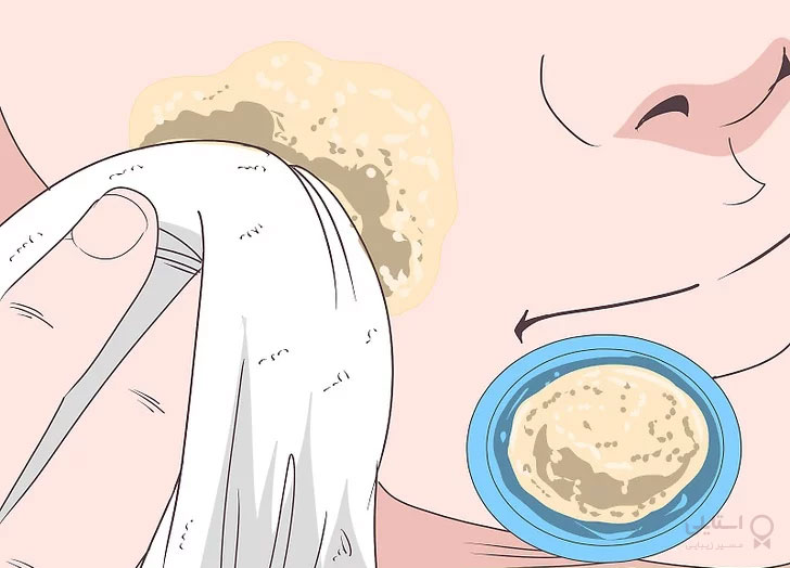 بٍورات پوستی