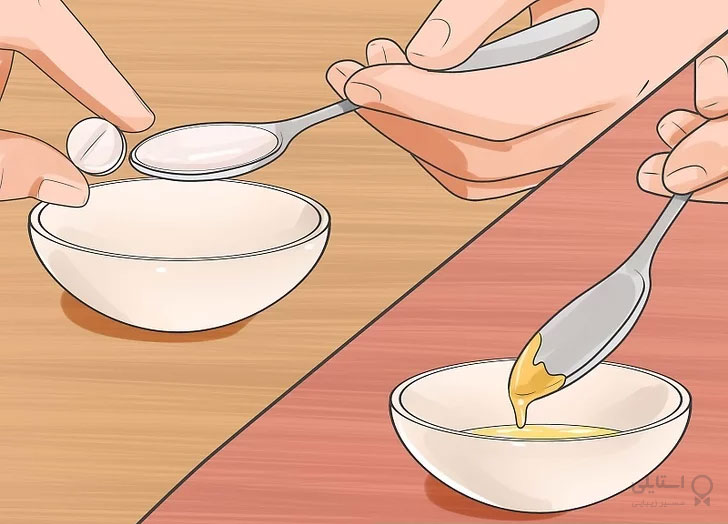 مو زیرپوستی