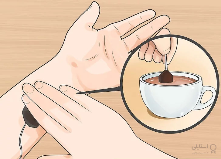 مو زیرپوستی