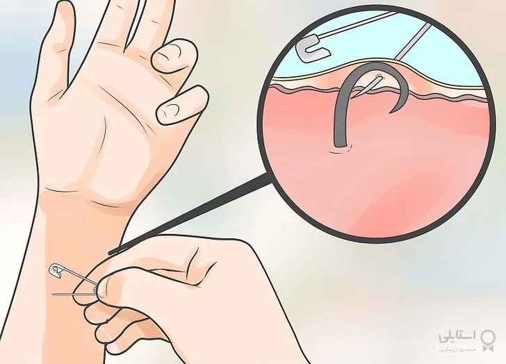 مو زیرپوستی