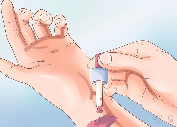 کرم ضد پیری