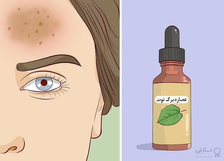 عصاره برگ توت را امتحان کنید