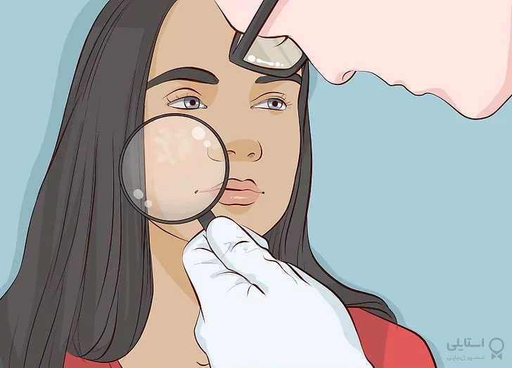 از متخصص پوست خود نسخه‌ای برای تهیه رتینوئید درخواست کنید